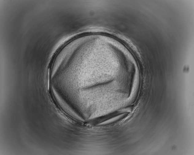 X0000099451175200805301506