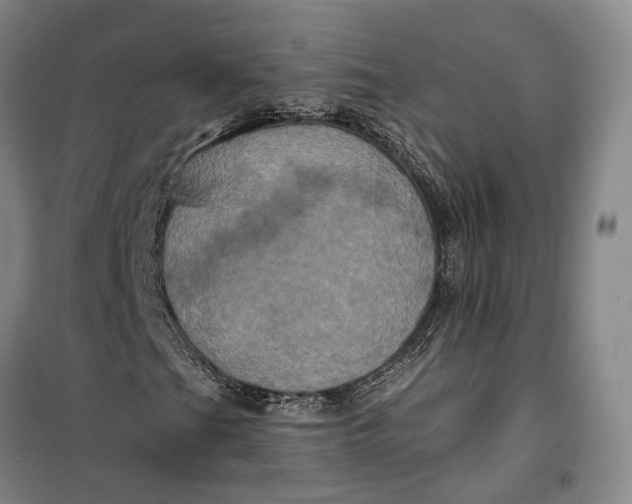 X0000099451201200805301505