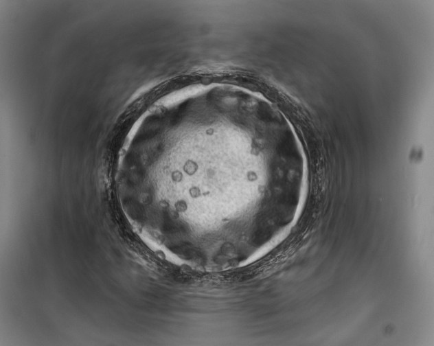 X0000099451206200805301505