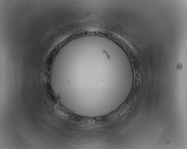 X0000099451207200805301505