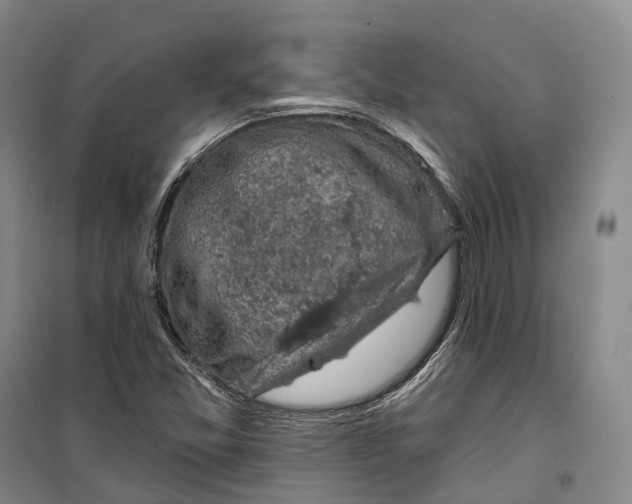 X0000099451357200805301503