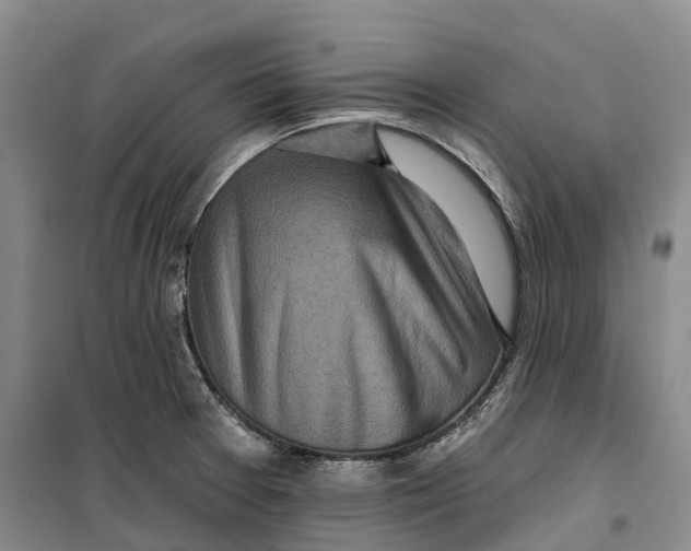 X0000099451377200805301503