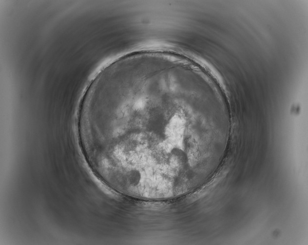 X0000099451429200805301503