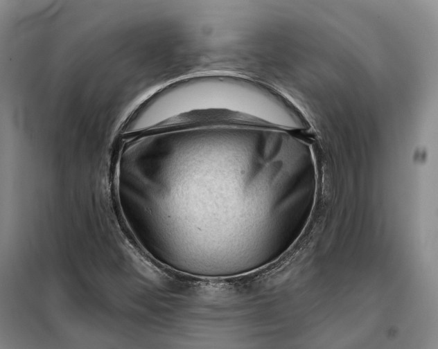 X0000099451452200805301502