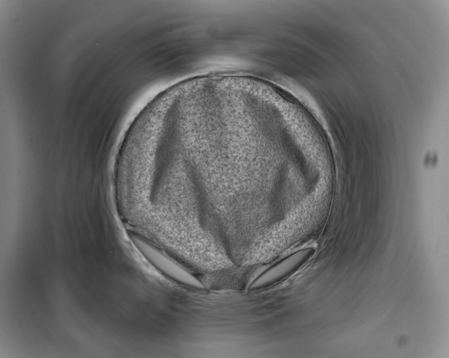 X0000099451488200805301501