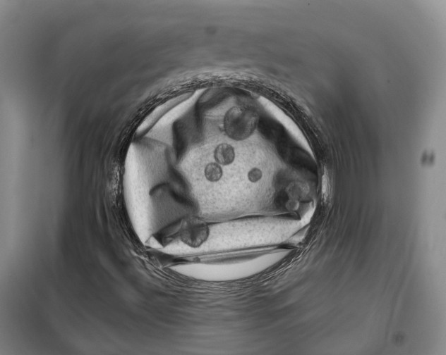 X0000099451492200805301501