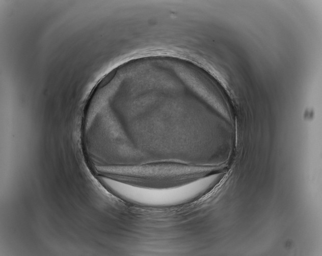 X0000099451500200805301501