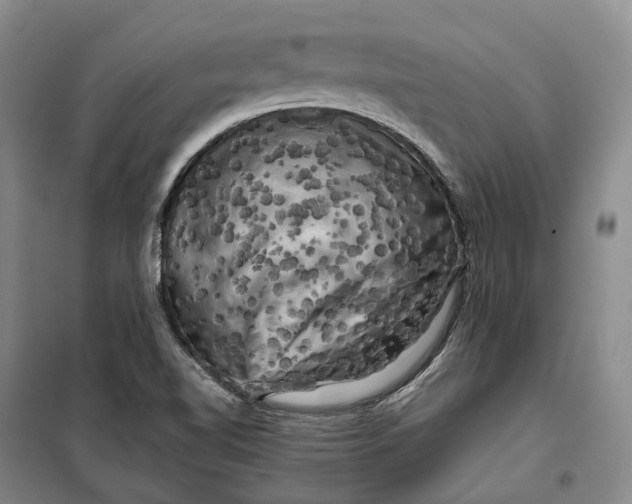 X0000099451510200805301501