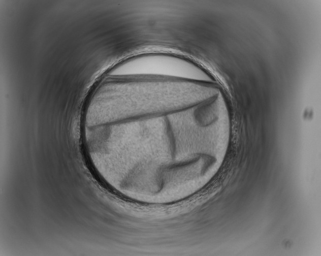 X0000099450015200806061116