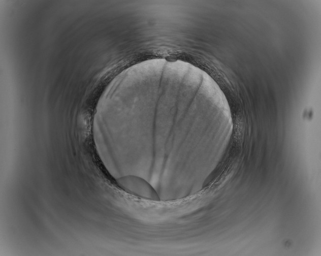 X0000099450043200806061116