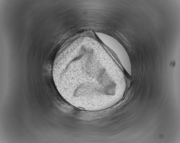 X0000099450045200806061116