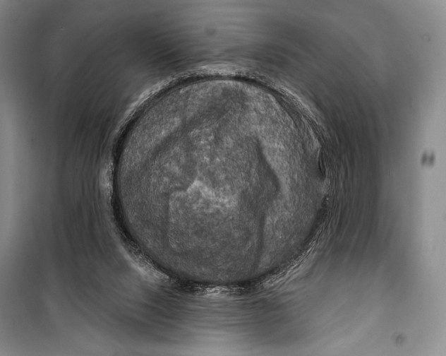 X0000099450064200806061115