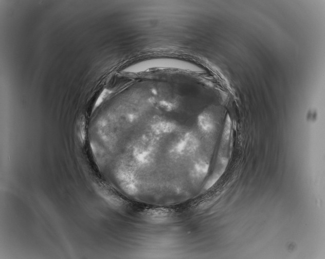 X0000099450069200806061115