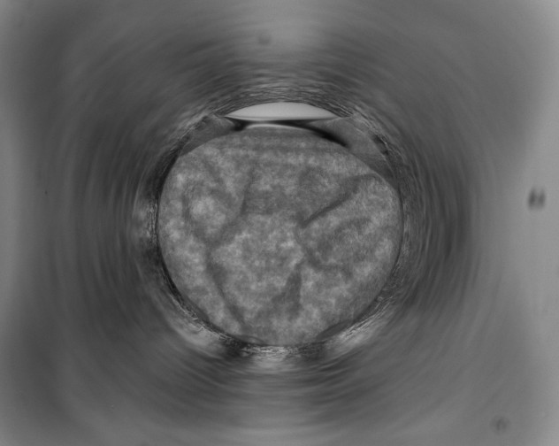 X0000099450096200806061116