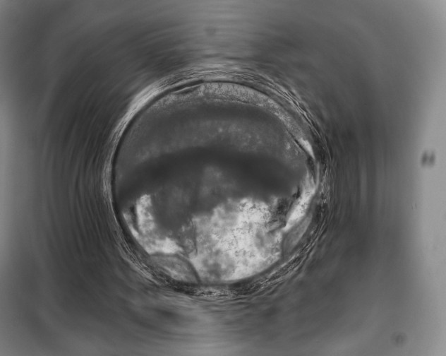 X0000099450099200806061115