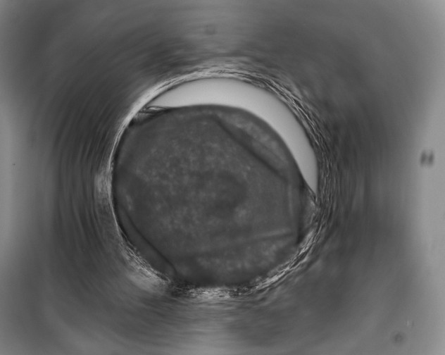 X0000099450100200806061115