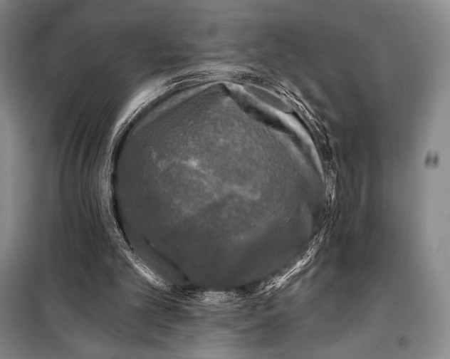 X0000099450101200806061115