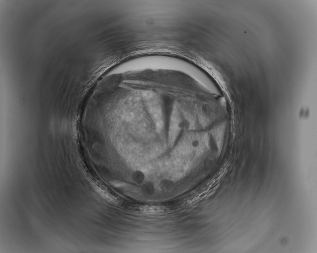 X0000099450105200806061115