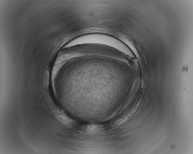 X0000099450109200806061115