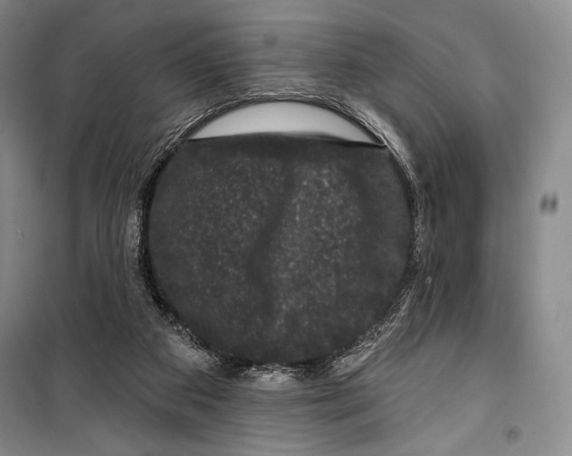 X0000099450113200806061115