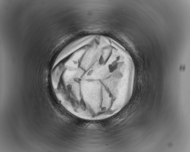 X0000099450115200806061115