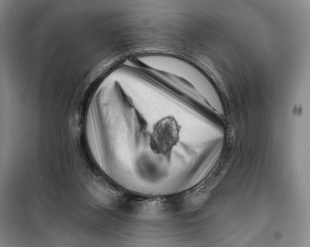 X0000099450116200806061115