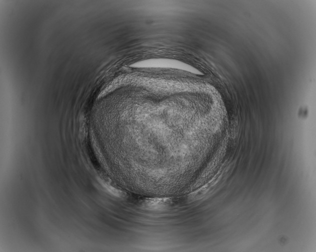 X0000099450136200806061115