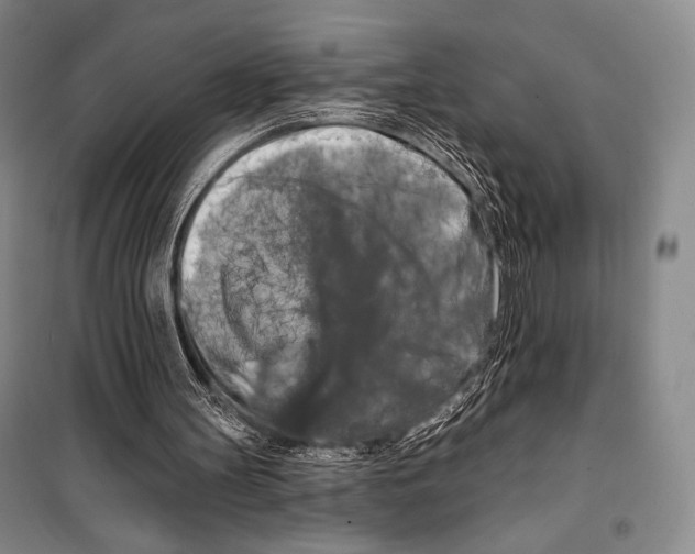 X0000099450147200806061114