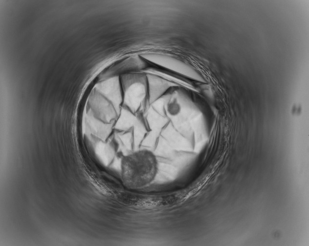 X0000099450148200806061114