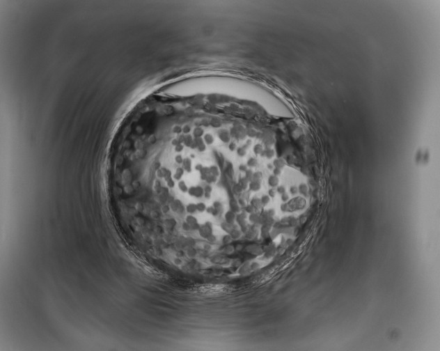 X0000099450152200806061114