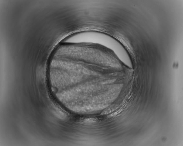 X0000099450156200806061114