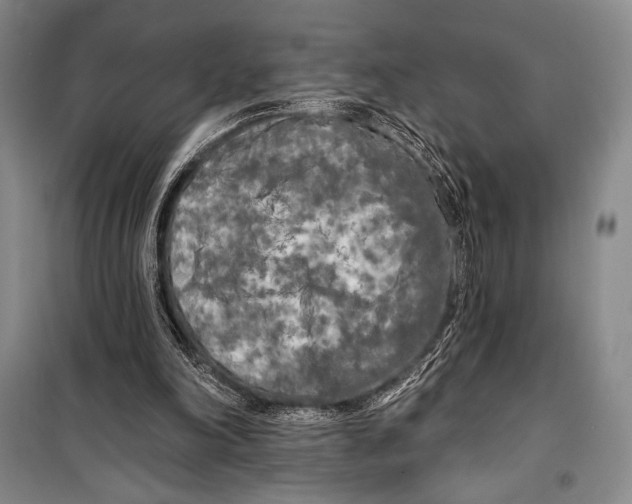 X0000099450198200806061114