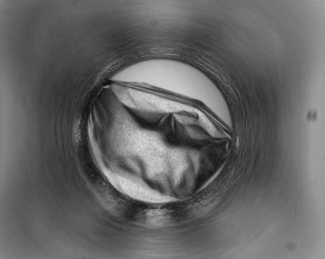 X0000099450216200806061113