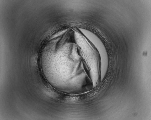 X0000099450217200806061113