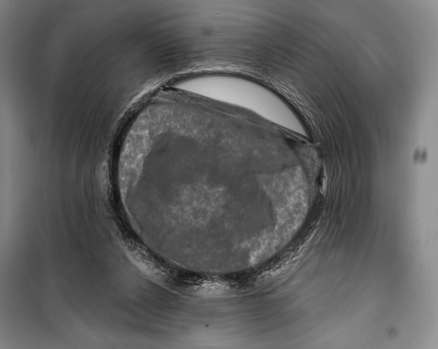 X0000099450256200806061112