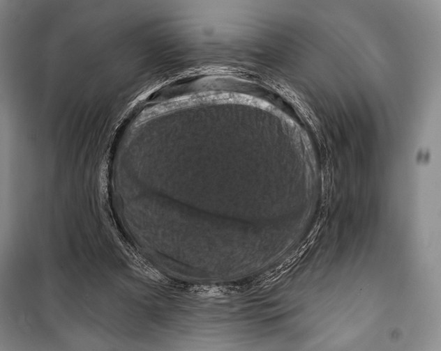 X0000099450297200806061112