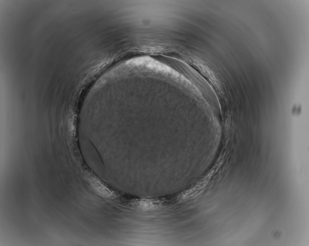 X0000099450305200806061112