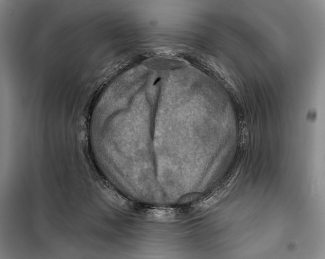 X0000099450317200806061112