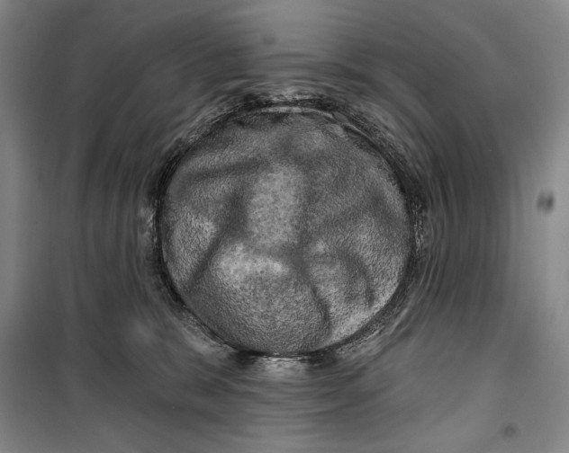 X0000099450327200806061112