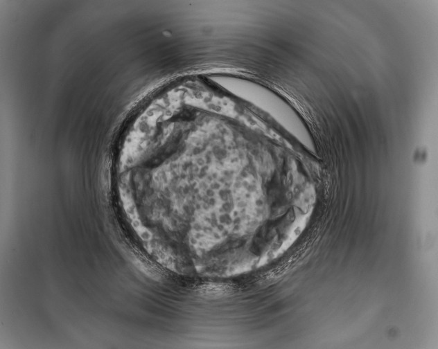 X0000099450350200806061111