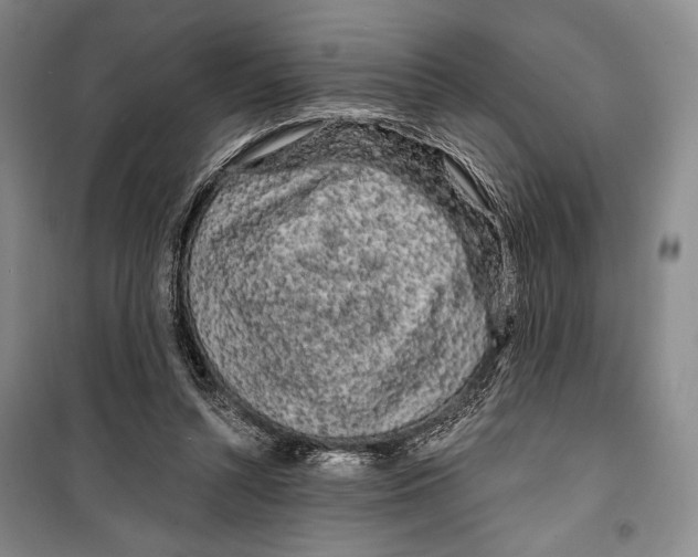 X0000099450352200806061111