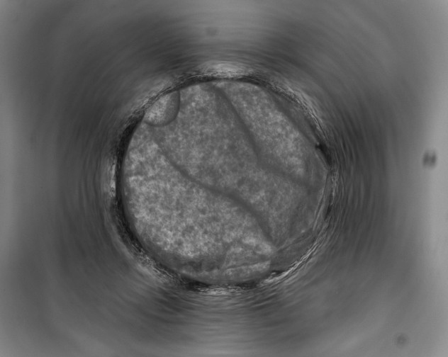 X0000099450358200806061111