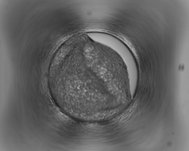 X0000099450385200806061111