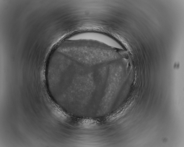 X0000099450399200806061111