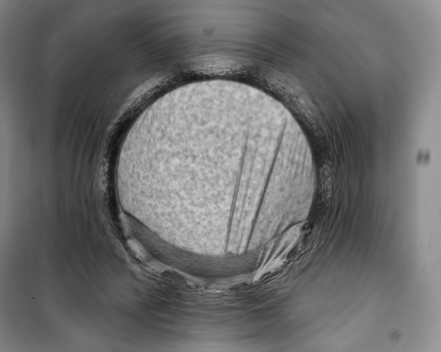 X0000099450400200806061111