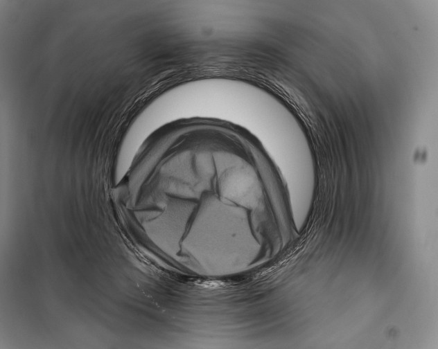 X0000099450409200806061110