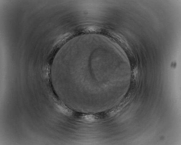 X0000099450423200806061110