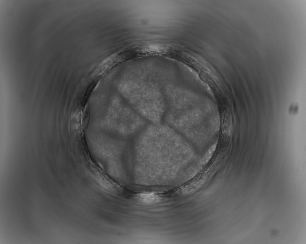 X0000099450425200806061110