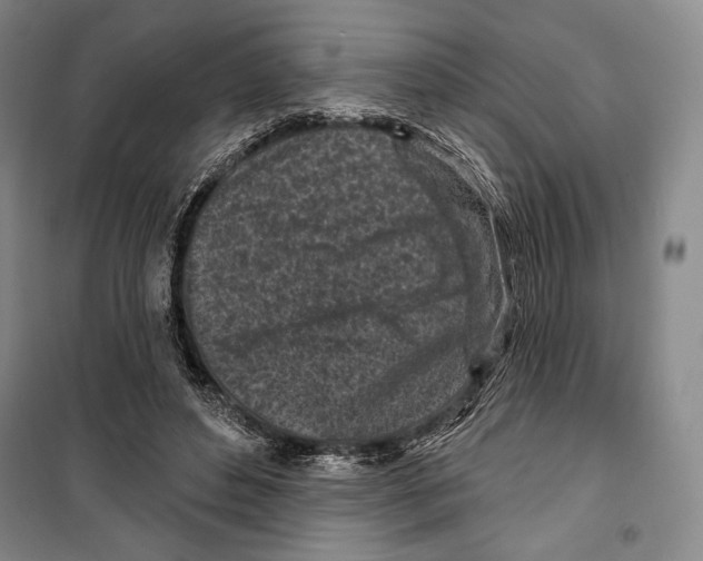 X0000099450496200806061109