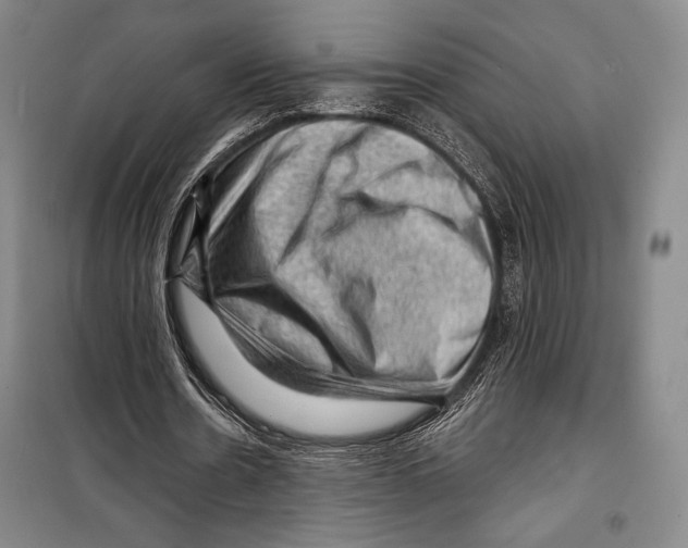 X0000099450530200806061108